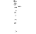Western blot testing of human HeLa cell lysate with BCMA antibody at 0.5ug/ml. Expected molecular weight: 96-110 kDa.