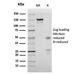 SDS-PAGE analysis of purified, BSA-free recombinant Bromodeoxyuridine antibody (clone rBRD469) as confirmation of integrity and purity.