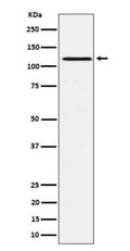 Western blot testing of lysate from human Ramos cells treated with pervanadate, using Phospho-JAK1 (Tyr1034/1035) antibody. Phospho-JAK1 (Tyr1034/1035) detected in pervanadate-treated Ramos lysate as a single band at ~125â€“130 kDa, consistent with activated full-length JAK1.
