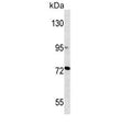 Western blot testing of human T-47D cell lysate with MMP2 antibody. Predicted molecular weight ~72 kDa.