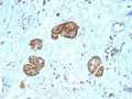 IHC staining of FFPE human colon tissue with recombinant CD56 antibody (clone NCAM1/9121R). HIER: boil tissue sections in pH 9 10mM Tris with 1mM EDTA for 20 min and allow to cool before testing.