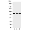 Western blot testing of IRAK antibody; Lane 1: HeLa; 2: U87; 3: MCF-7 cell lysate. Expected/observed size ~52KD
