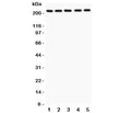 Western blot testing of TSC2 antibody and human samples 1: U20S; 2: PANC; 3: HEPG2; 4: A549; 5: COLO320. Expected/observed size 200~220KD