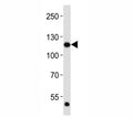 Western blot analysis of lysate from HeLa cell line using FGFR1 antibody at 1:2000. Predicted molecular weight: 75-160 kDa depending on glycosylation level.