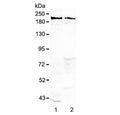 Western blot tesing of rat 1) brain and 2) testis lysate with Neurocan antibody at 0.5ug/ml. Predicted molecular weight ~143 kDa (unmodified), up to ~250 kDa (fully glycosylated).