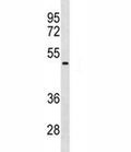 NEU1 antibody western blot analysis in HepG2 lysate. Predicted molecular weight ~45 kDa.