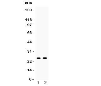 Western blot testing of PSCA antibody and Lane 1: rat stomach; 2: mouse stomach; Predicted size: 13KD; Observed glycosylated size: up to 29KD