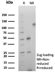 SDS-PAGE analysis of purified, BSA-free CD39 antibody (clone rCD39/8682) as confirmation of integrity and purity.