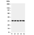 Western blot testing of LOX-1 antibody and Lane 1: HeLa; 2: SMMC-7721; 3: U87; 4: U937; 5: K562 lysate. Predicted molecular weight: pro-form 35-50 kDa, mature form ~31 kDa