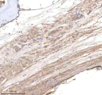 IHC staining of zebrafish Pi4kb protein using Zebrafish Pi4kb antibody, HRP-labeled secondary and DAB substrate. Pi4kb was detected in a paraffin-embedded section of zebrafish spinal tissue. HIER: boil tissue sections in pH8 EDTA for 20 min and allow to cool before testing.