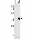 Western blot analysis of HLA-G antibody and 293 cell lysate either nontransfected (Lane 1) or transiently transfected (2) with the HLA-G gene.