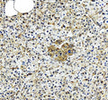 Immunohistochemical staining of EIF2A using anti-EIF2A antibody. EIF2A was detected in a paraffin-embedded section of human pancreas tissue. Heat mediated antigen retrieval was performed in EDTA buffer (pH 8.0, epitope retrieval solution). The tissue section was blocked with 10% goat serum. The tissue section was then incubated with 2 ug/ml rabbit anti-EIF2A antibody overnight at 4oC. Peroxidase Conjugated Goat Anti-rabbit IgG was used as secondary antibody and incubated for 30 minutes at 37oC. The tissue s