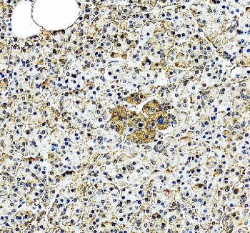 Immunohistochemical staining of EIF2A using anti-EIF2A antibody. EIF2A was detected in a paraffin-embedded section of human pancreas tissue. Heat mediated antigen retrieval was performed in EDTA buffer (pH 8.0, epitope retrieval solution). The tissue section was blocked with 10% goat serum. The tissue section was then incubated with 2 ug/ml rabbit anti-EIF2A antibody overnight at 4oC. Peroxidase Conjugated Goat Anti-rabbit IgG was used as secondary antibody and incubated for 30 minutes at 37oC. The tissue s