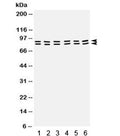 Western blot testing of rat 1) testis, 2) brain, 3) liver, and human 4) placenta, 5) MCF7, and 6) SW620 lysate with STAT1 antibody. Predicted/observed molecular weight: ~91/84 kDa (alpha/beta).