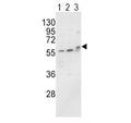 Western blot analysis of ALP / Alkaline Phosphatase antibody and MCF-7 (lane 1), HL-60 cell line (2) and mouse brain tissue (3) lysate. Predicted molecular weight ~57 kDa, but can be observed at up to ~75 kDa due to glycosylation.