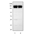 Western blot testing of mouse 1) ANA-1 and 2) RAW264.7 cell lysate with Integrin alpha M antibody. Expected molecular weight: 127~170 kDa depending on glycosylation level.