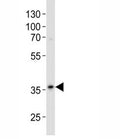 Western blot analysis of lysate from A375 cell line using anti-GAPDH antibody diluted at 1:500. Predicted molecular weight ~36kDa.