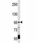 TRPV5 antibody western blot analysis in HepG2 lysate.