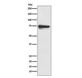 Western blot testing of human melanoma lysate with Tyrosinase antibody. Predicted molecular weight: 60-84 kDa depending on level of glycosylation.