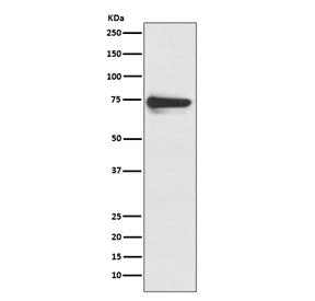 Western blot testing of human melanoma lysate with Tyrosinase antibody. Predicted molecular weight: 60-84 kDa depending on level of glycosylation.