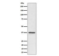Western blot testing of human U-87 MG cell lysate with C3orf38 antibody. Predicted molecular weight ~37 kDa.