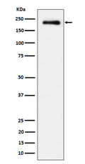 Western blot analysis of Phospho-EGFR (Y869) expression in treated with EGF cell lysate using Phospho-EGFR (Tyr845) antibody.
