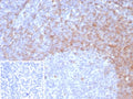IHC staining of FFPE human tonsil tissue with IgD antibody (clone IGHD/8326R). Inset: PBS used in place of primary Ab (secondary Ab negative control). HIER: boil tissue sections in pH 9 10mM Tris with 1mM EDTA for 20 min and allow to cool before testing.