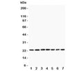 Western blot testing of CNTF antibody and rat samples 1: PC12; 2: NRK; 3: RH35; 4: brain; 5: liver; 6: spleen; 7: testis lysate. Expected/observed molecular weight ~23 kDa.