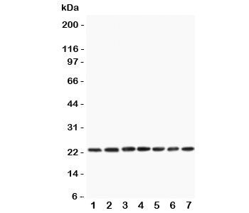 Western blot testing of CNTF antibody and rat samples 1: PC12; 2: NRK; 3: RH35; 4: brain; 5: liver; 6: spleen; 7: testis lysate. Expected/observed molecular weight ~23 kDa.