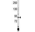 Dnmt3a antibody western blot analysis in HL-60 lysate