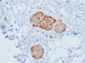 IHC testing of human pancreas tissue with recombinant CHGA antibody (rCHGA/777). Required HIER: boil tissue sections in 10mM citrate buffer, pH 6, for 10-20 min followed by cooling at RT for 20 min.