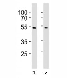Western blot analysis of lysate from 1) HepG2 and 2) HUVEC cell line using SUV39H2 antibody at 1:1000. Expected molecular weight: 40-53 kDa.