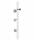 CFC1B antibody western blot analysis in NCI-H292 lysate