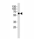 Western blot analysis of lysate from rat lung tissue using SMAD1 antibody at 1:1000. Predicted molecular weight: 52~60 kDa.