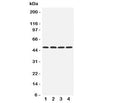 Western blot testing of HYAL1 antibody and Lane 1: rat NRK; 2: mouse liver; 3: (m) kidney; 4: (m) SP2/0 cell lysate