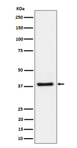 Western blot analysis of UCHL5IP/HAUS7 expression in human Jurkat cell lysate using HAUS7 antibody. Predicted molecular weight ~40 kDa.