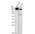 Western blot testing of mouse and rat brain tissue lysate using the BCLAF1 antibody at 1:2000 dilution for 1 hour at room temperature. A predominant band is detected at approximately 150 kDa in both samples, running above the predicted ~106 kDa but consistent with the apparent molecular weight reported for the heavily modified nuclear protein BCLAF1 in peer reviewed studies.