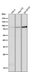 All lanes use the PRKCA/B/G antibody at 1:5K dilution for 1 hour at room temperature.