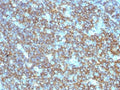 IHC testing of CD20 antibody and FFPE human tonsil tissue. Required HIER: steam section in pH6 citrate buffer for 20 min.