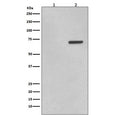 Western blot testing of lysate from human HeLa cells 1) untreated and 2) treated with Anisomycin, with phospho-ATF2 antibody (pT71). Expected molecular weight: 65-70 kDa.