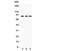 Western blot testing of PKC epsilon antibody and Lane 1: rat brain; 2: Mosue brain; 3: human MCF-7. Predicted/observed size ~84KD