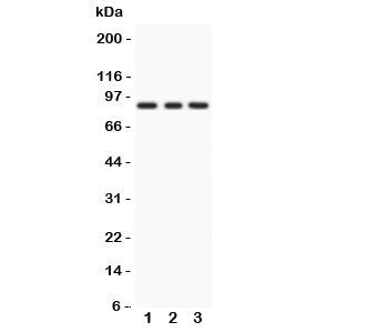 Western blot testing of PKC epsilon antibody and Lane 1: rat brain; 2: Mosue brain; 3: human MCF-7. Predicted/observed size ~84KD