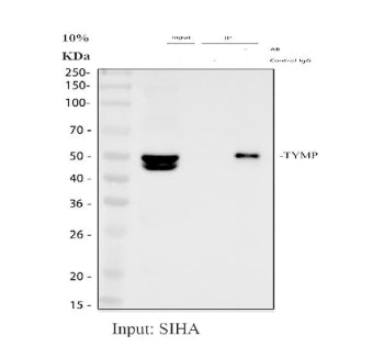 Immunoprecipitating PD-ECGF/TYMP in SiHa whole cell lysate. Western blot analysis of PD-ECGF/TYMP using anti-TYMP antibody. Lane 1: SiHa whole cell lysates (30ug), Lane 2: Rabbit control IgG instead of anti-TYMP antibody in SiHa whole cell lysate, Lane 3: anti-TYMP antibody (2ug) + SiHa whole cell lysate (500ug). After electrophoresis, proteins were transferred to a membrane. Then the membrane was incubated with rabbit anti-TYMP antibody at a dilution of 0.5 ug/ml and probed with a goat anti-rabbit IgG-HRP