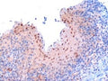 IHC testing of FFPE human tonsil with RANBP9 antibody at 3ug/ml. Microwaved antigen retrieval with Tris/EDTA buffer pH9, HRP-staining.