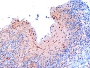 IHC testing of FFPE human tonsil with RANBP9 antibody at 3ug/ml. Microwaved antigen retrieval with Tris/EDTA buffer pH9, HRP-staining.