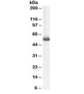Western blot testing of human liver lysate with ALDH1 antibody at 1ug/ml. Predicted molecular weight ~55 kDa.