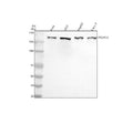 Western blot analysis of POLR1A using anti-POLR1A antibody. Lane 1: human Hela whole cell lysates, Lane 2: human 293T whole cell lysates, Lane 3: human HepG2 whole cell lysates, Lane 4: human Caco-2 whole cell lysates. After electrophoresis, proteins were transferred to a nitrocellulose membrane at 150 mA for 50-90 min. Blocked the membrane with 5% non-fat milk/TBS for 1.5 hour at RT.