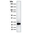 Western blot testing of human kidney lysate with recombinant Ferritin Light Chain antibody (clone FTL/3872R). Predicted molecular weight: ~20 kDa.