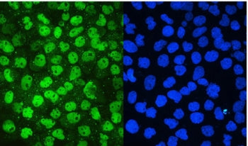 IF/ICC staining of FFPE human A431 cells with MCM2 antibody (green) at 2ug/ml and DAPI nuclear stain (blue). HIER: steam section in pH6 citrate buffer for 20 min.