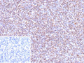 IHC staining of FFPE human tonsil tissue with recombinant Epstein-Barr Virus antibody (clone EBV/9619R). Inset: PBS used in place of primary Ab (secondary Ab negative control).